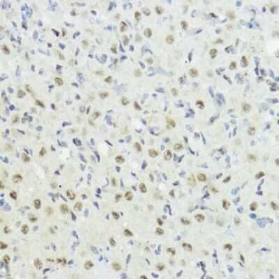 Immunohistochemistry-Paraffin: Histone H3 [p Thr32] Antibody [NBP3-16009] - Rat ovary using Histone H3 antibody (NBP3-16009) at dilution of 1:100 (40x lens).Perform microwave antigen retrieval with 10 mM Tris/EDTA buffer pH 9.0 before commencing with IHC staining protocol.